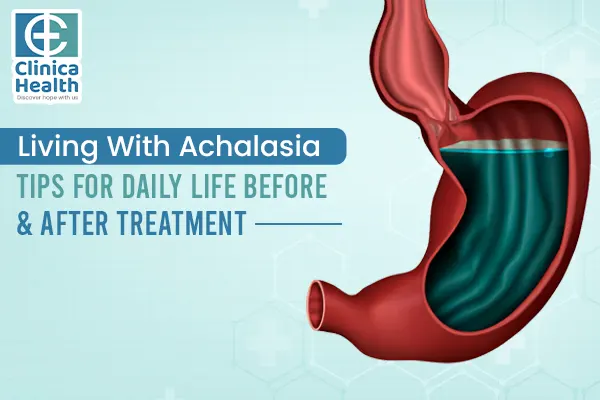 Achalasia Cardia Treatment