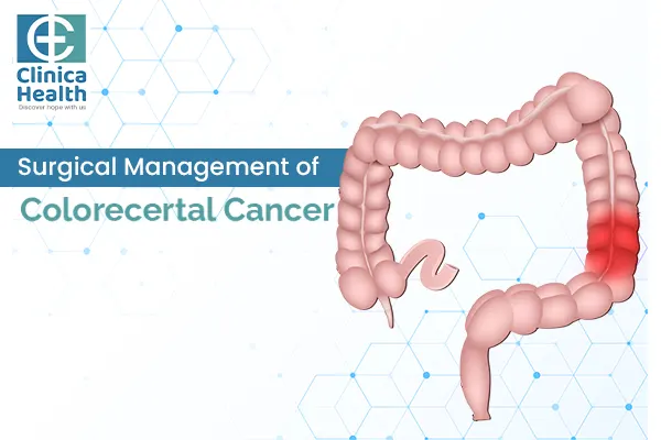 Surgical Management of Colorectal Cancer