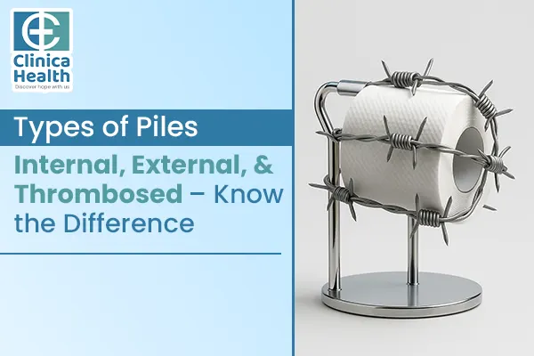 piles