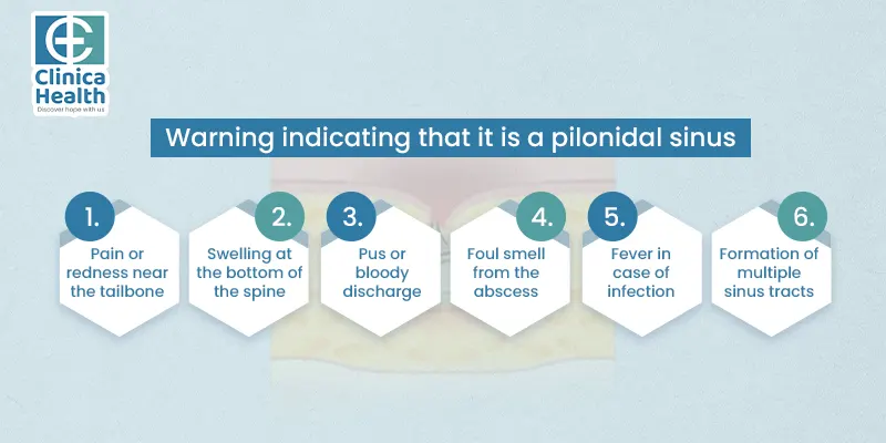 Pilonidal Sinus Surgery
