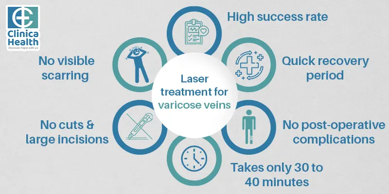 varicose veins treatment