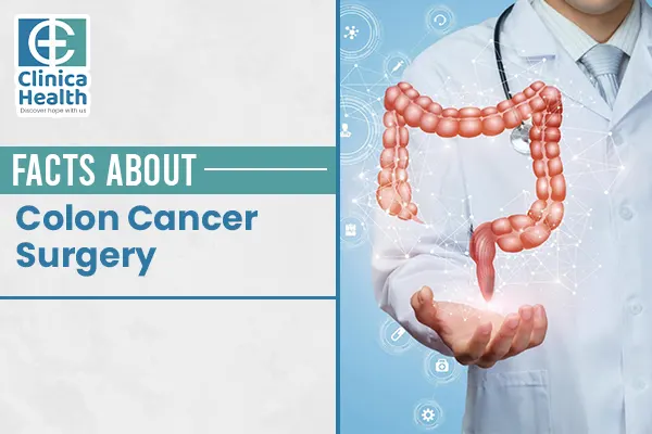 colon cancer surgery