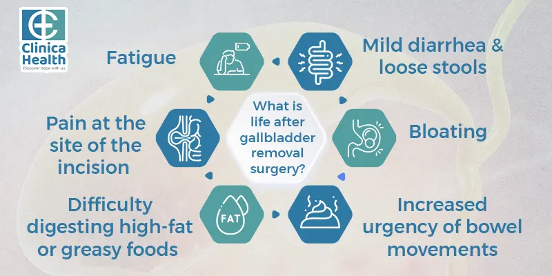 Gallbladder Removal Surgery