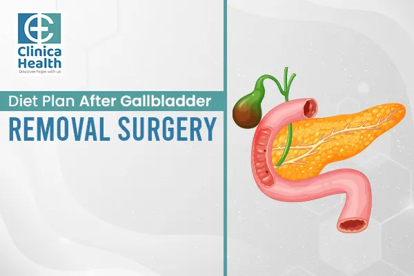 Gallbladder Removal Surgery