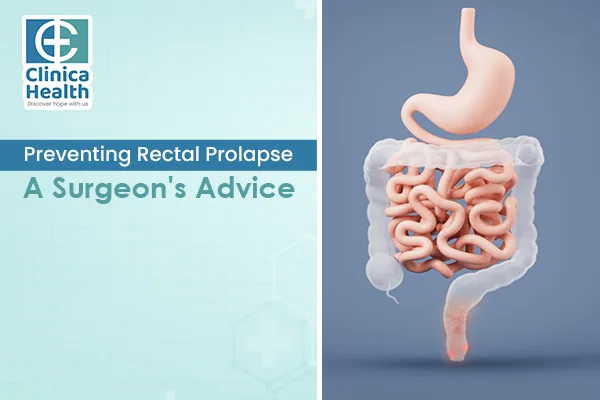 rectal prolapse surgery