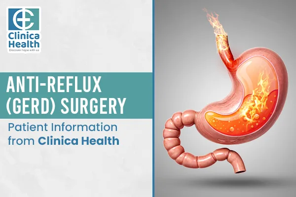 GERD treatment surgery