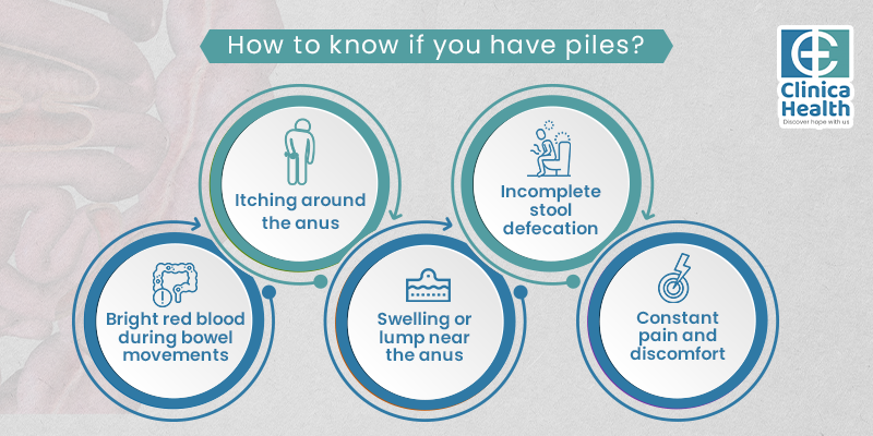 laser piles surgery in Kolkata