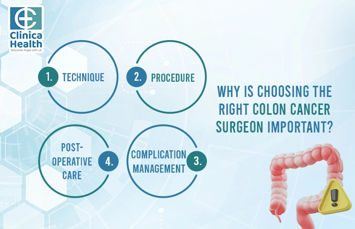 colon Cancer Surgery