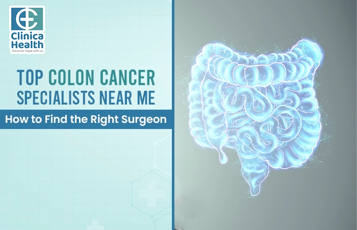 colon Cancer Surgery