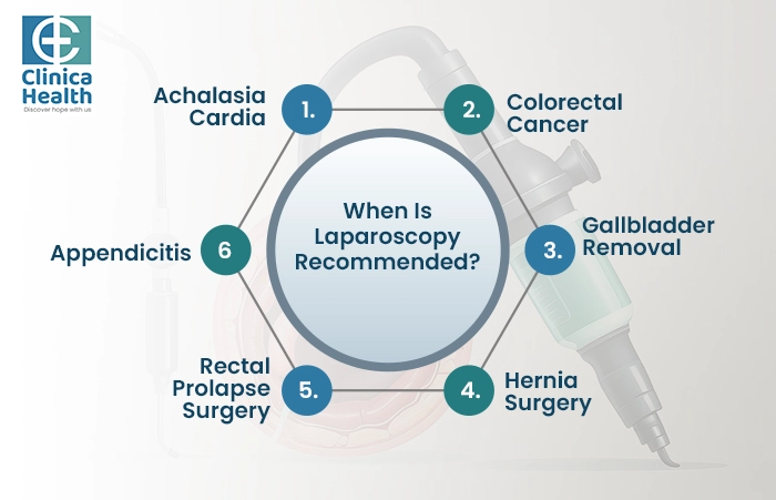 Laparoscopic Surgery In Kolkata