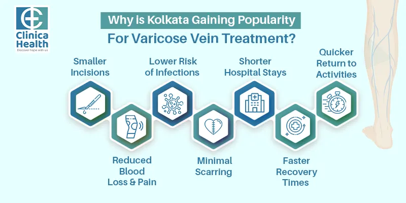 varicose vein surgery