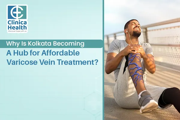 varicose vein surgery