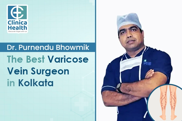 varicose vein surgeon in Kolkata