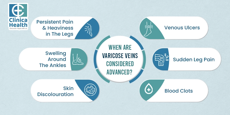 varicose vein surgeon in Kolkata