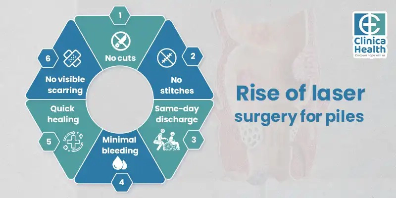 Laser Piles Surgery