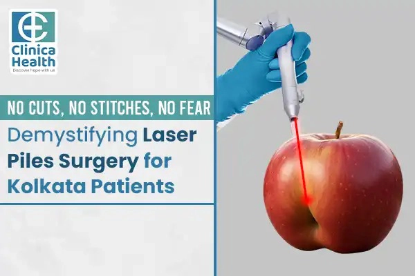 Laser Piles Surgery