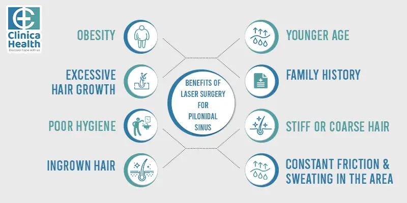 laser surgery for pilonidal sinus