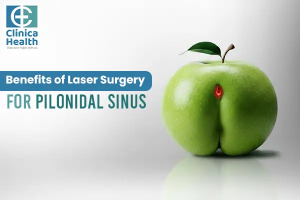 laser surgery for pilonidal sinus
