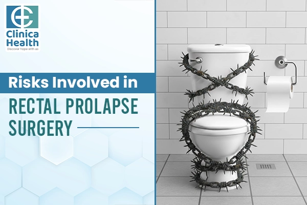 rectal prolapse surgery