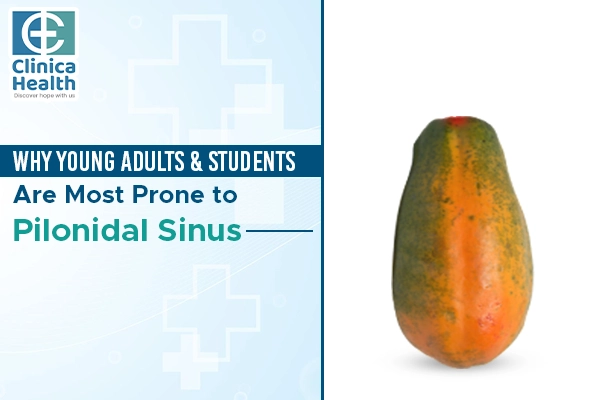 laser surgery for pilonidal sinus