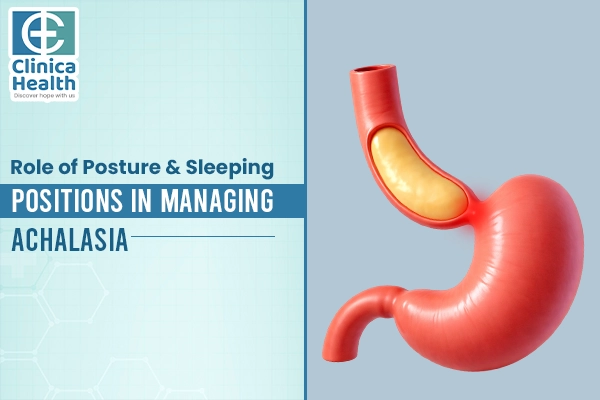 Achalasia Cardia Treatment