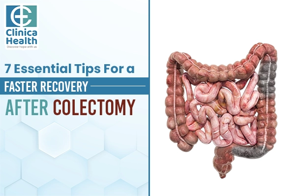 colorectal cancer surgery