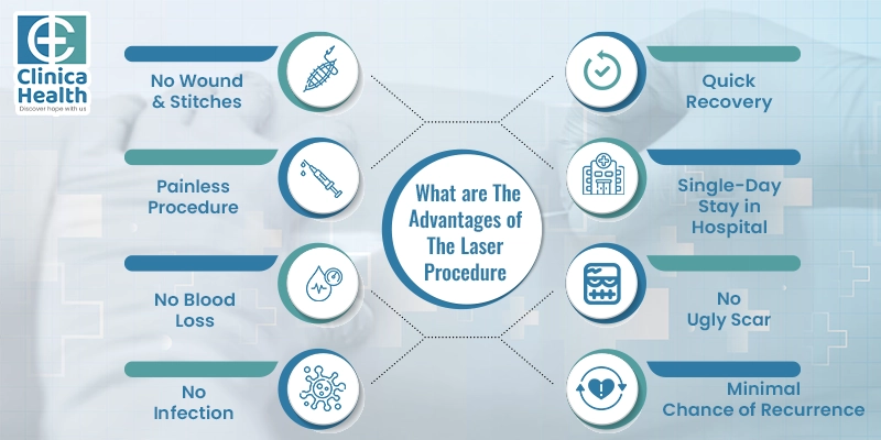 laser varicose vein surgery costs