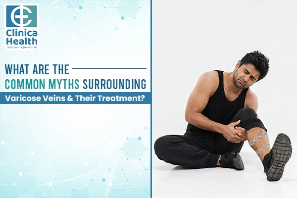 laser varicose vein surgery costs