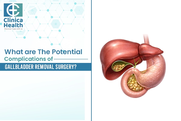 Gallbladder surgeon in Kolkata