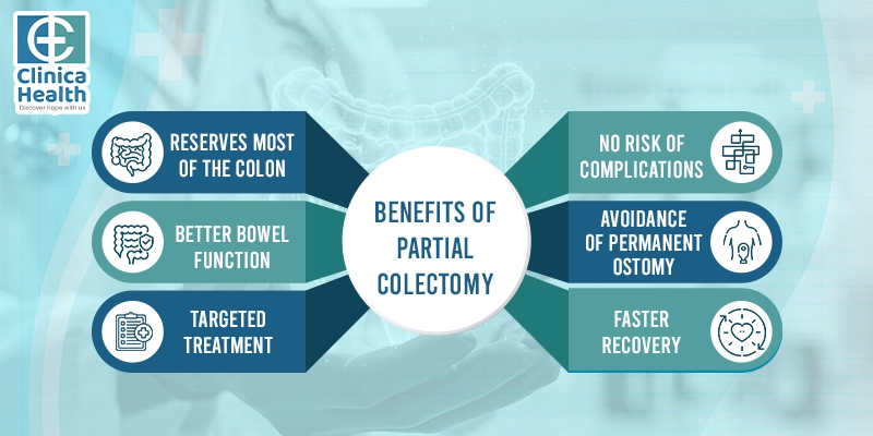 colorectal cancer surgery