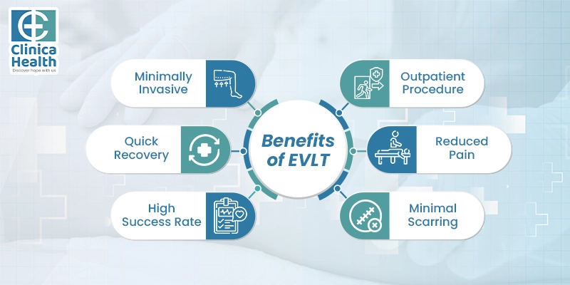 varicose vein treatment