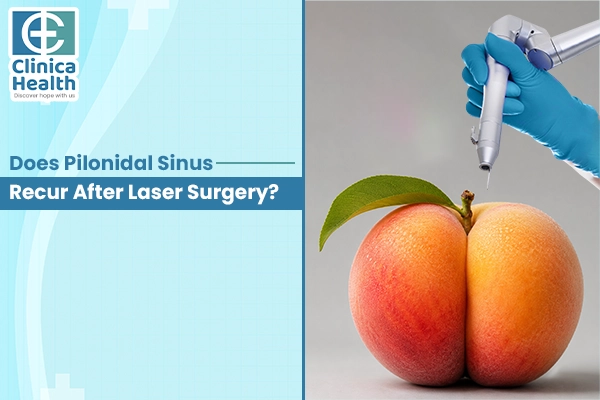 pilonidal sinus