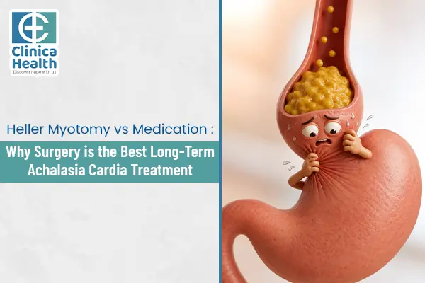 Achalasia Cardia Surgical Treatment