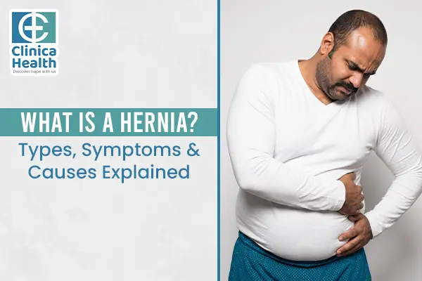 hernia surgery