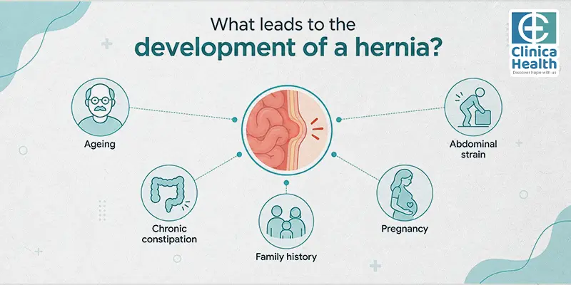 hernia surgery