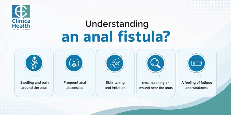 fistula surgeon