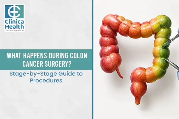 colon cancer surgery